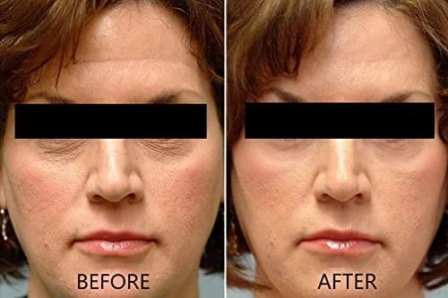 Vitamin C Serum 20% Pure L-Ascorbic Acid — image 7