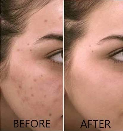 Vitamin C Serum 20% Pure L-Ascorbic Acid — image 6