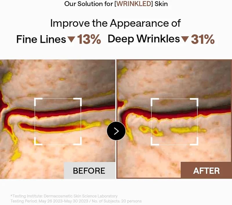 Mediheal Retinol Collagen Under Eye Patches - Korean Hydrogel Eye Pads (60 — image 6