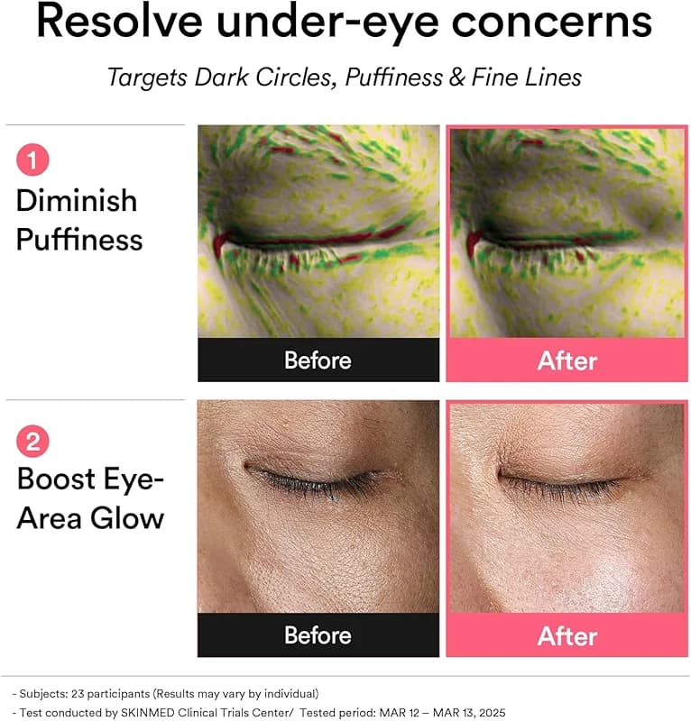 Abib PDRN Retinal Eye Patches for Rejuvenating & Puffy Eyes with Glow Jelly — image 7