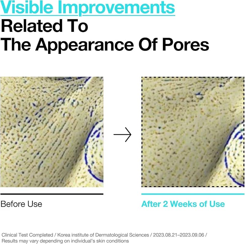 ANUA BHA 2% Gentle Exfoliating Toner — image 7