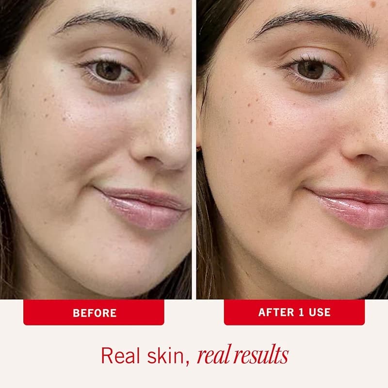 First Aid Beauty Ultra Repair Face Moisturizer — image 5