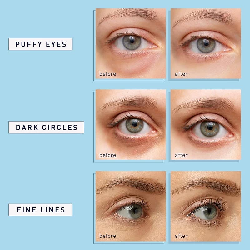 Enaskin Naturals Under Eye Patches for Dark Circles: 30 Pairs Retinol — image 6