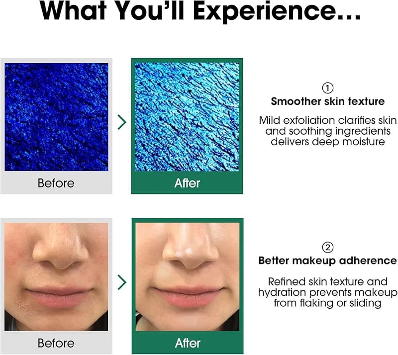 SOME BY MI AHA BHA PHA 30 Days Miracle Toner – 5.07oz — image 6