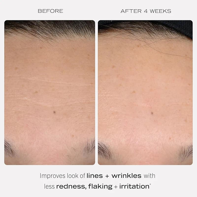 First Aid Beauty - 0.3% Retinol Complex Serum with Peptides — image 6