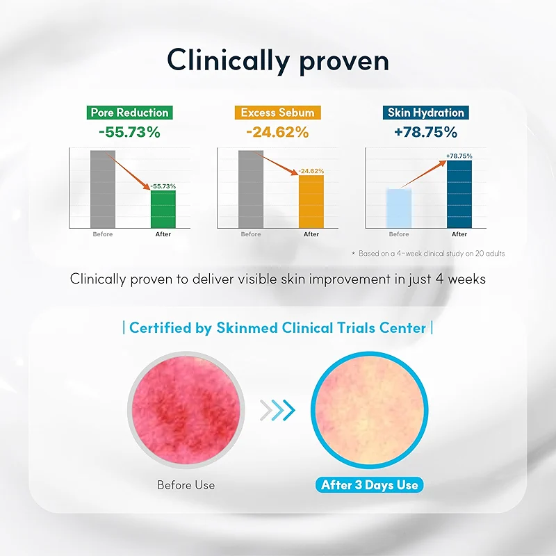 S.NATURE Pore Refining Moisturizer for Dry & Sensitive Skin – Squalane — image 2