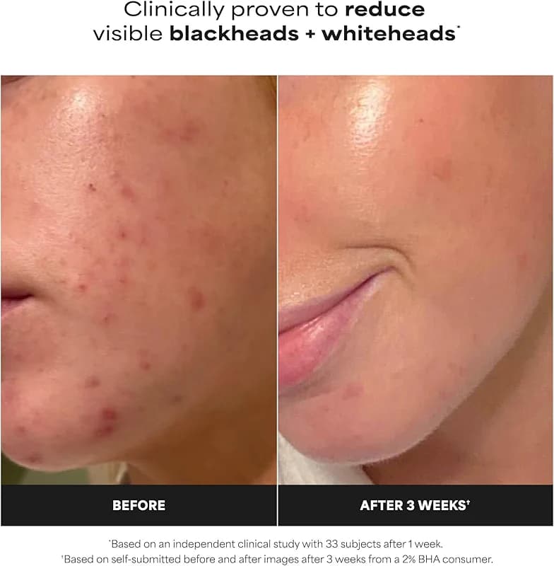 Paula's Choice SKIN PERFECTING 2% BHA Liquid Exfoliant with Salicylic Acid — image 3