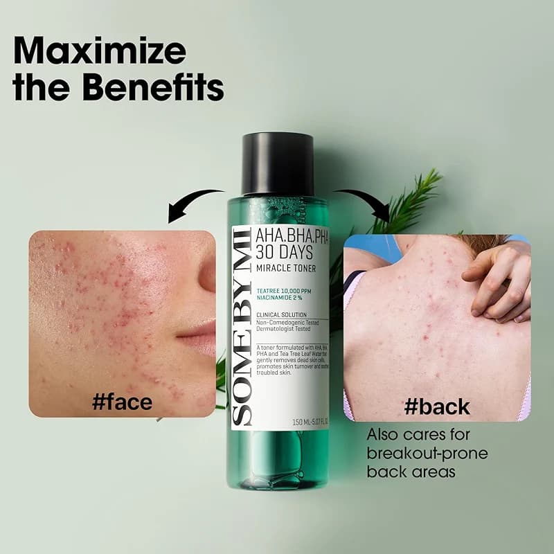 SOME BY MI AHA BHA PHA 30 Days Miracle Toner – 5.07oz — image 8