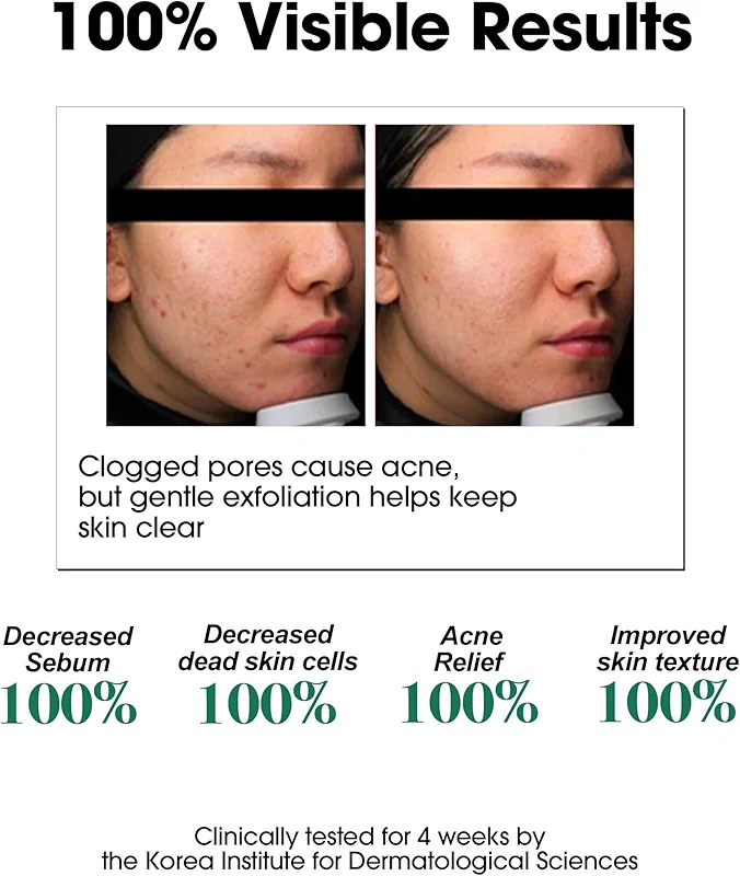 SOME BY MI AHA BHA PHA 30 Days Miracle Toner – 5.07oz — image 4