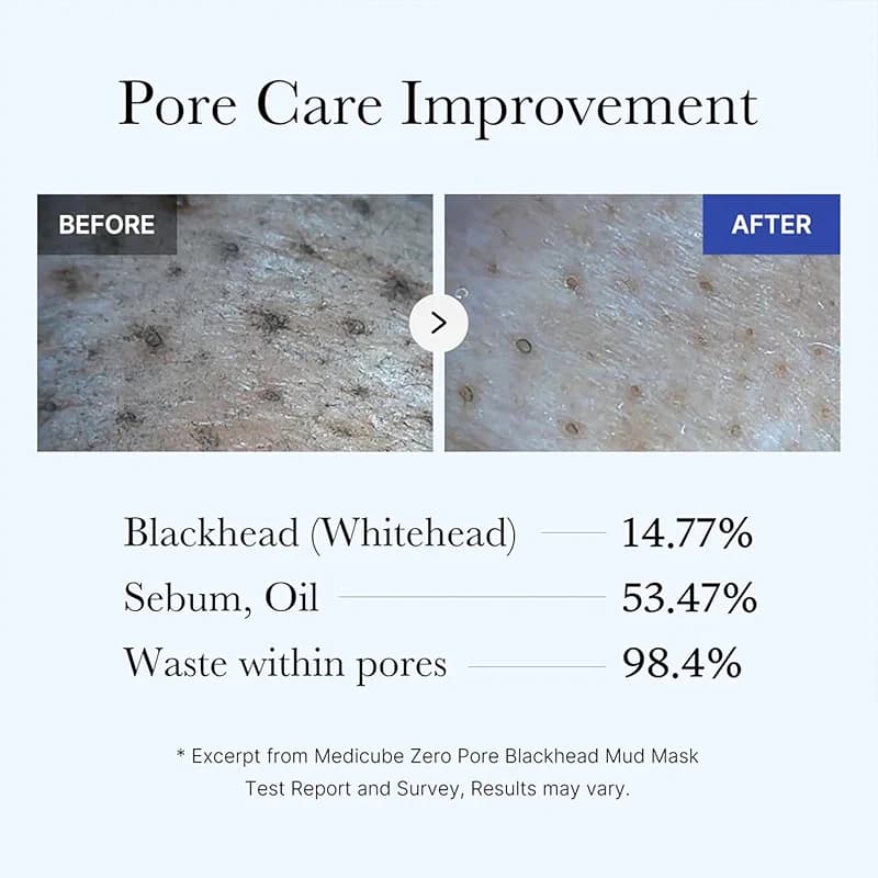 Medicube Zero Pore Blackhead Mud Facial Mask - Skin Cooling & Pore — image 2