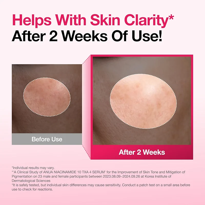 Anua Niacinamide 10 + TXA 4 Serum — image 7