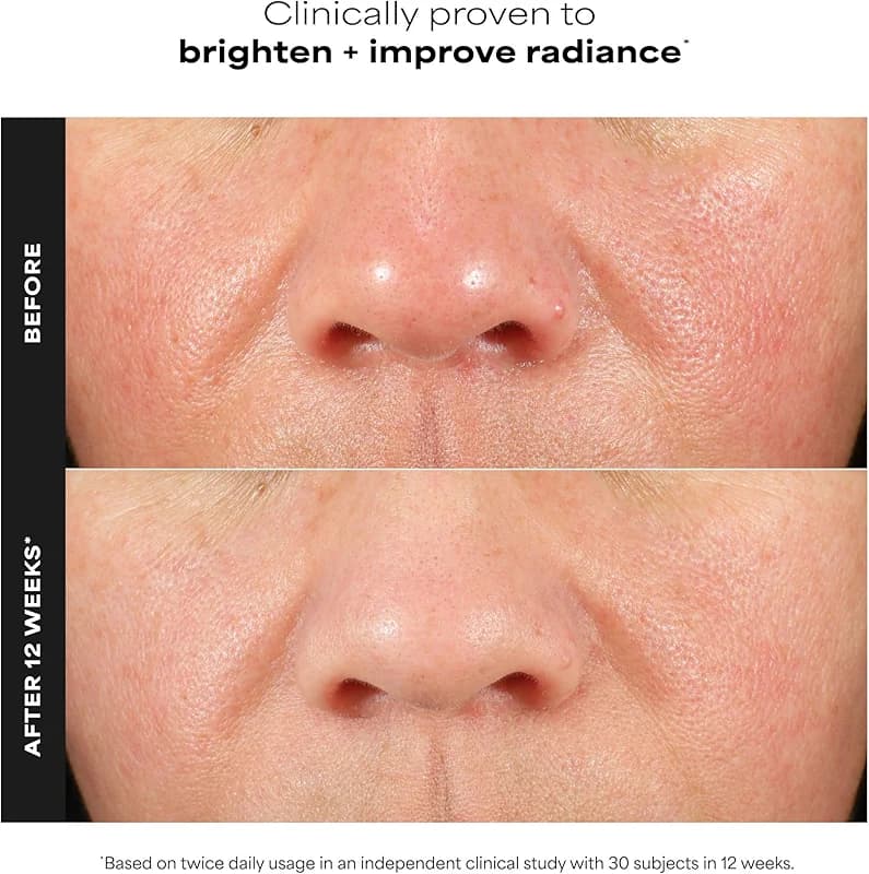 Paula's Choice BOOST C15 Super Booster — image 5