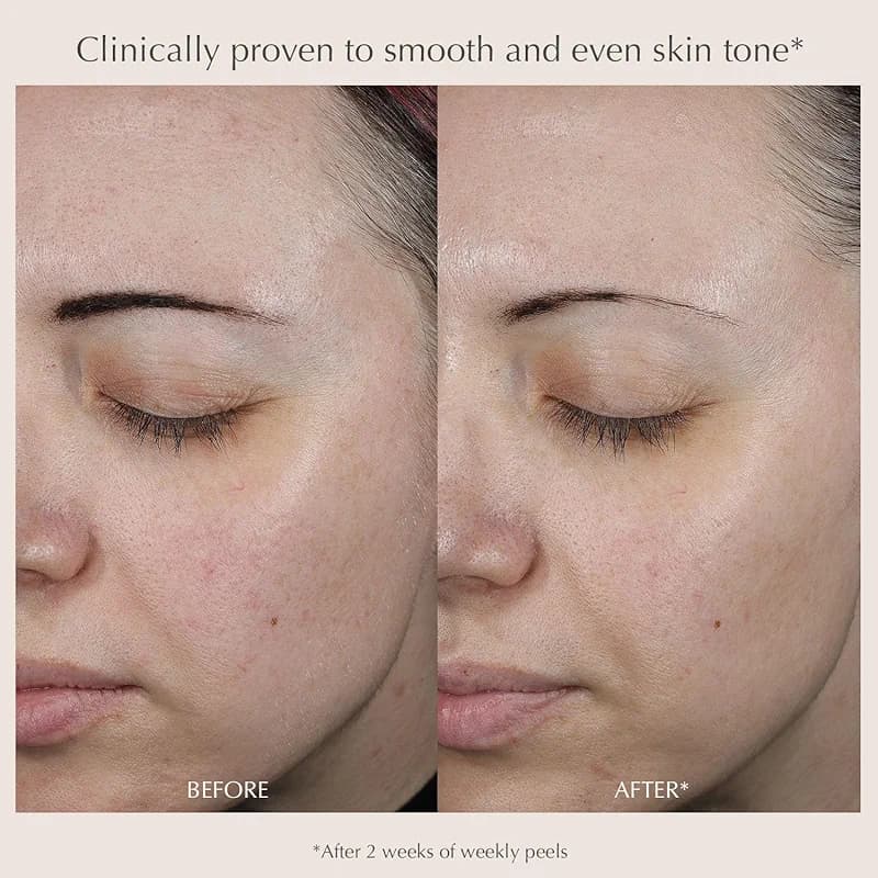 EXUVIANCE Performance Peel AP25 — image 4