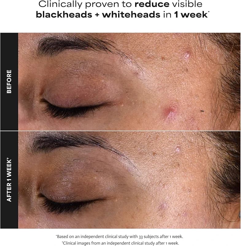 Paula's Choice SKIN PERFECTING 2% BHA Liquid Exfoliant with Salicylic Acid — image 4