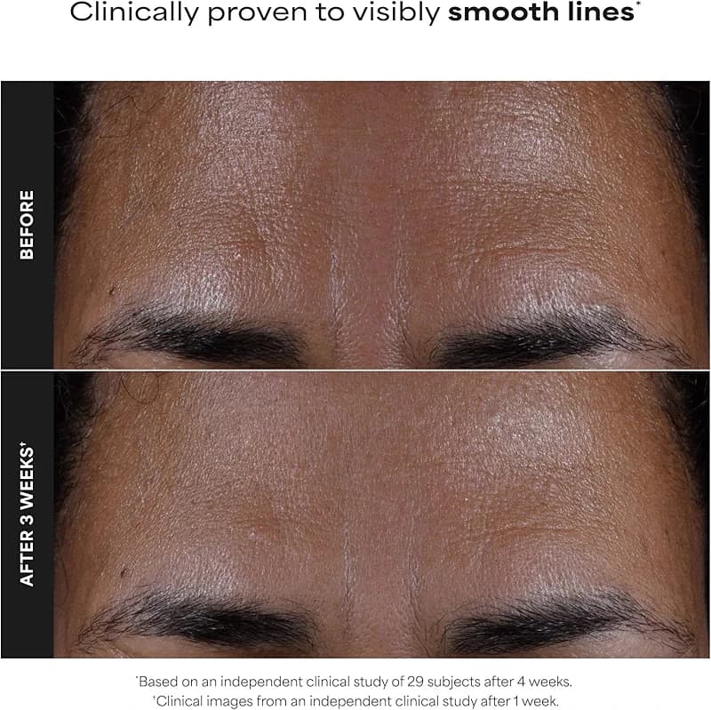 Paula's Choice SKIN PERFECTING 2% BHA Liquid Exfoliant with Salicylic Acid — image 5