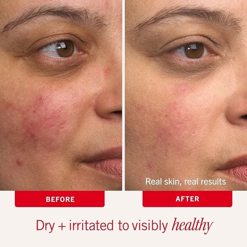 First Aid Beauty Ultra Repair Cream – Whipped Face & Body Moisturizer with — image 8