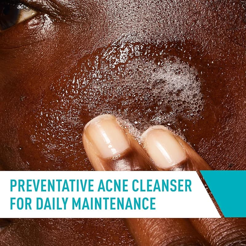 CeraVe Acne Control Cleanser — image 7