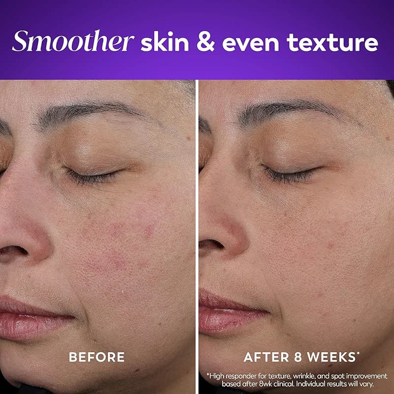 Olay Retinol Night Cream for Women — image 3