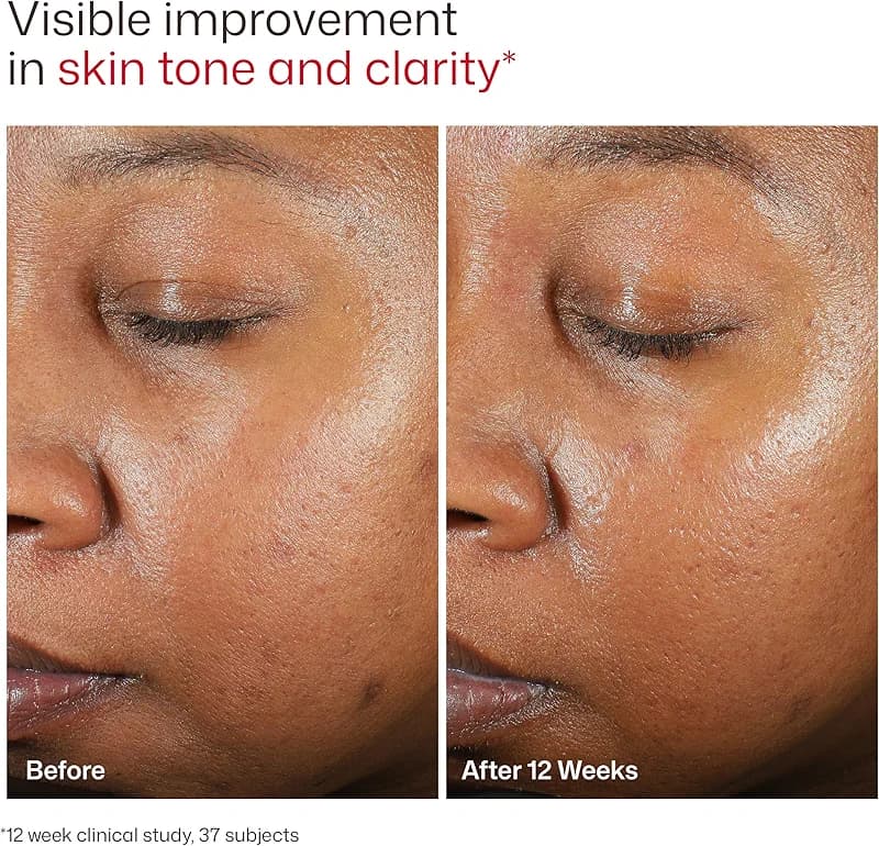 EltaMD UV Clear Face Sunscreen — image 7